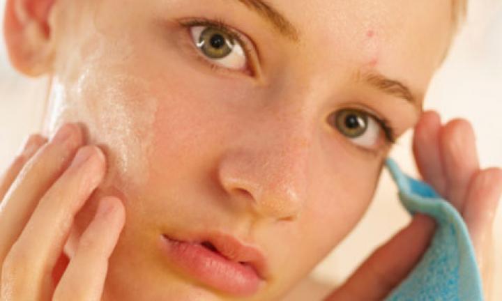 Survive Your Teenage Years with Natural Acne Remedies